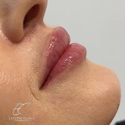 Grossé Aesthetic - Wrocław